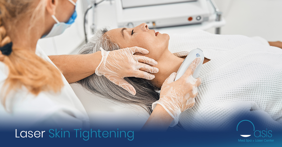 Skin Tightening Treatment, Laser Skin tightening