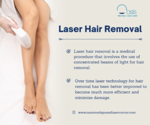 Laser hair on sale removal dallas