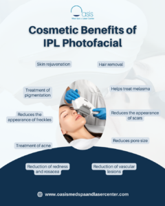 Cosmetic Benefits of IPL Photofacial