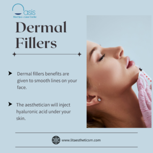 Dermal Fillers in Dallas, TX