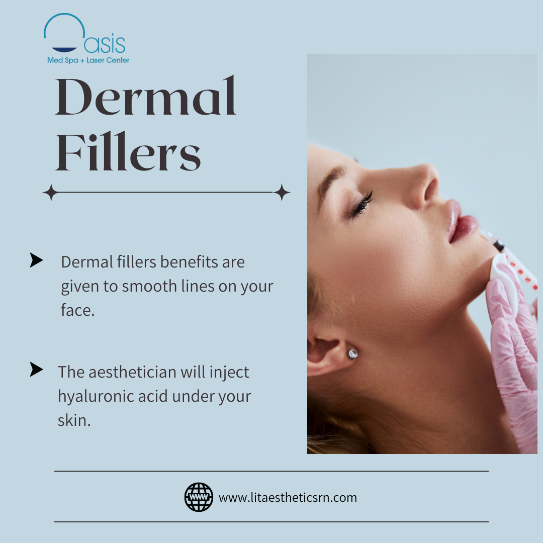 Unveiling the Stunning Benefits of Dermal Fillers in Dallas, Tx