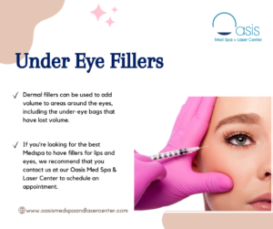 Under Eye Fillers Dallas, TX