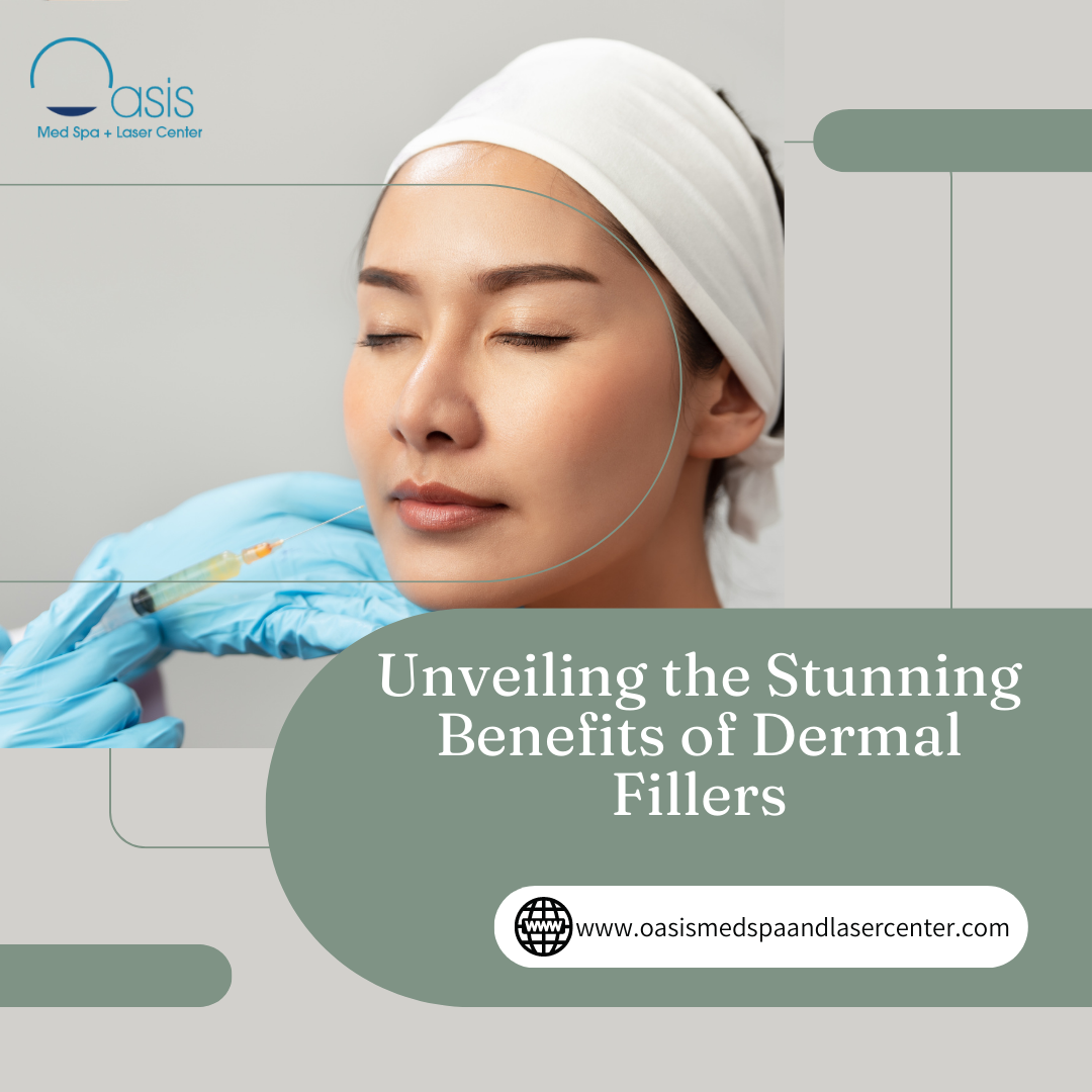 Unveiling the Stunning Benefits of Dermal Fillers