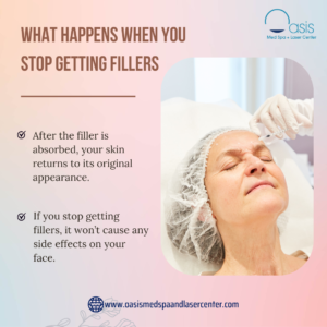 What happens when you stop getting fillers?