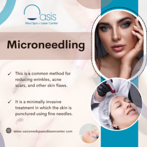 Microneedling in Dallas, Tx 