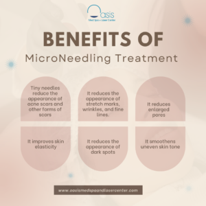 Benefits of MicroNeedling Treatment