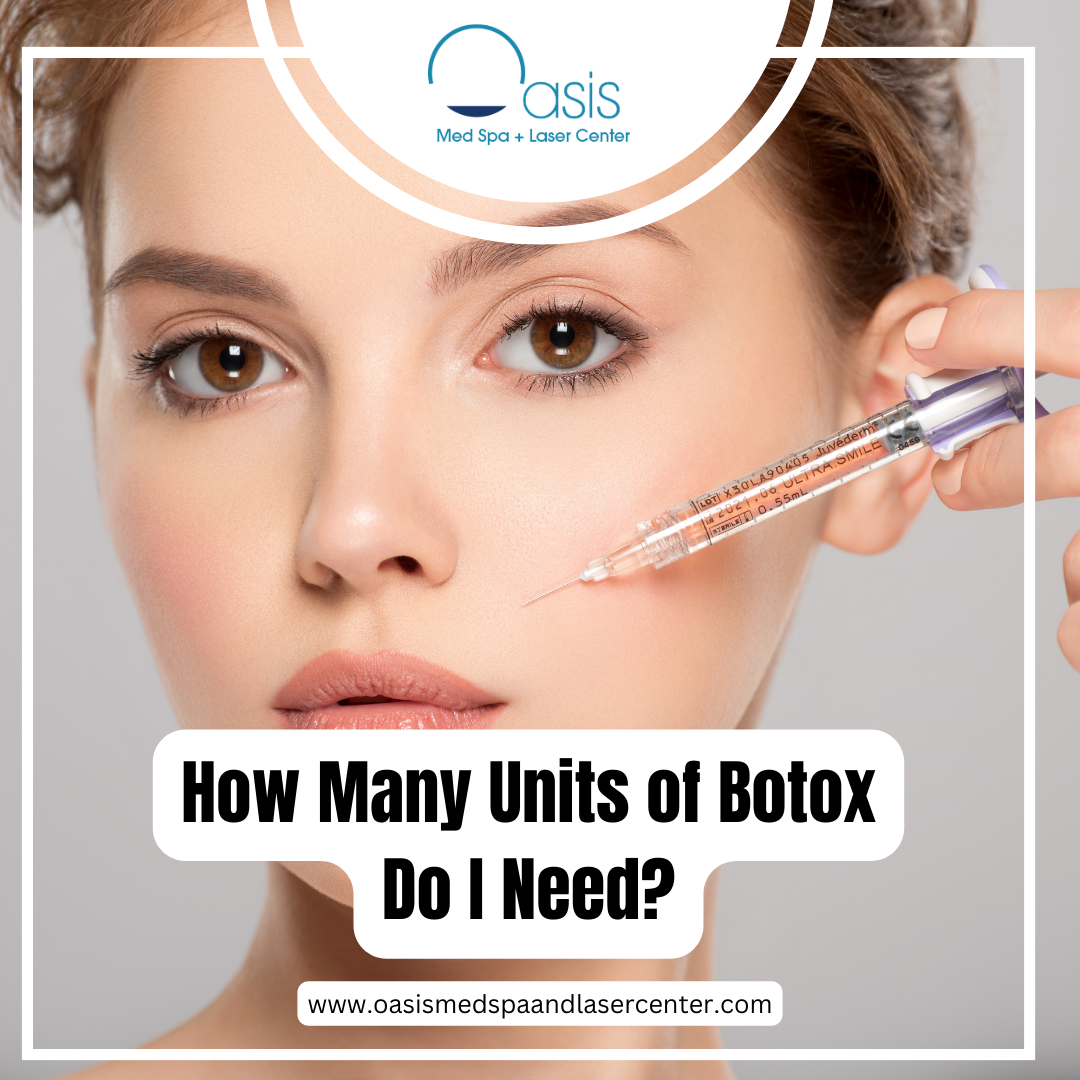 How Many Units of Botox Do I Need