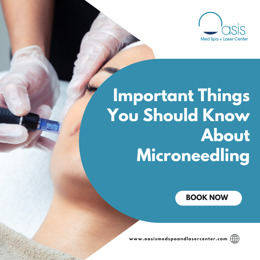 Important Things You Should Know About Microneedling