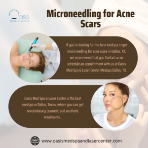 Best Medspa to get Microneedling for Acne Scars