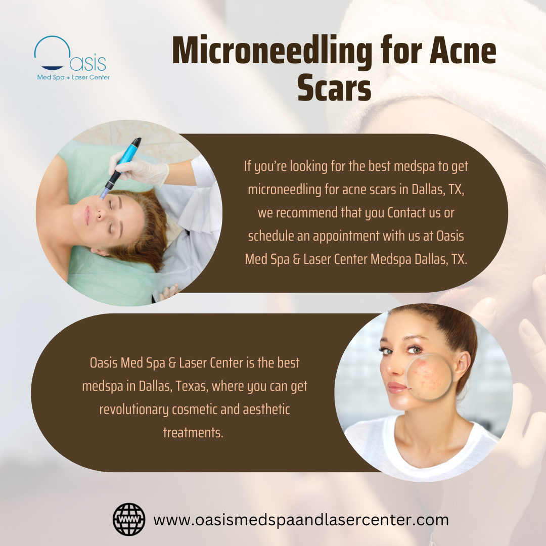 Effectiveness of Microneedling for Acne Scars Dallas, TX Insights