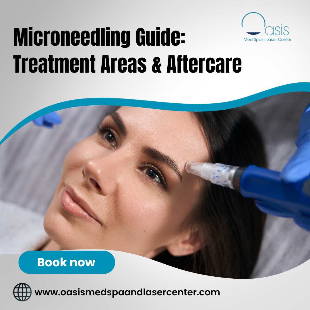 Microneedling Guide: Treatment Areas & Aftercare