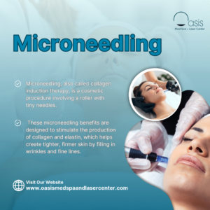 Microneedling in Dallas, TX 