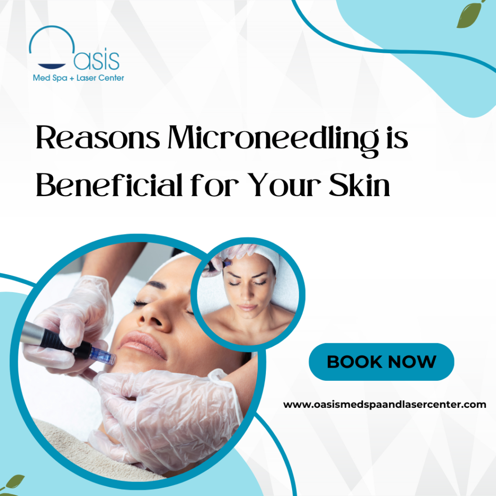 Reasons Microneedling is Beneficial for Your Skin