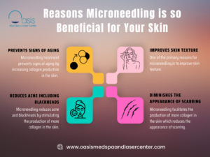 Reasons Microneedling is so Beneficial for Your Skin