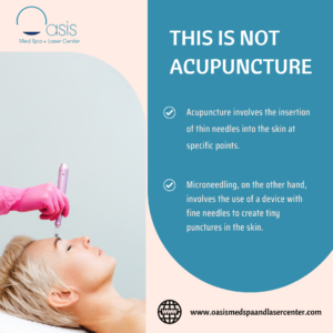 This is not acupuncture