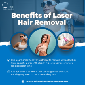 Benefits of Laser Hair Removal 