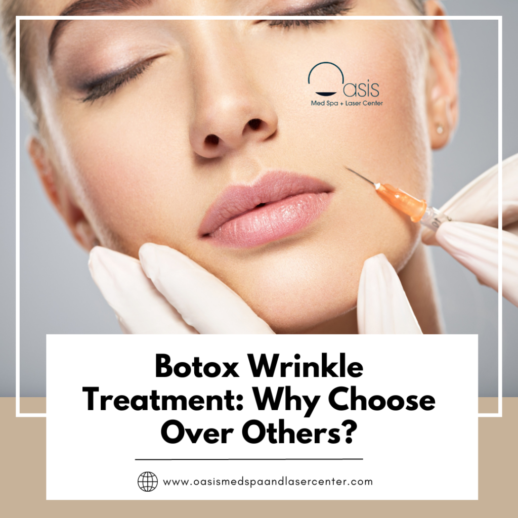 Botox Wrinkle Treatment Why Choose Over Others