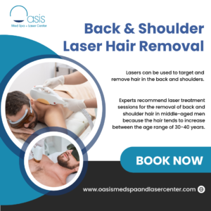 Back & Shoulder Laser Hair Removal