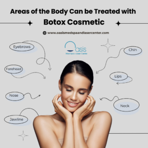 Areas of the Body Can be Treated with Botox Cosmetic 