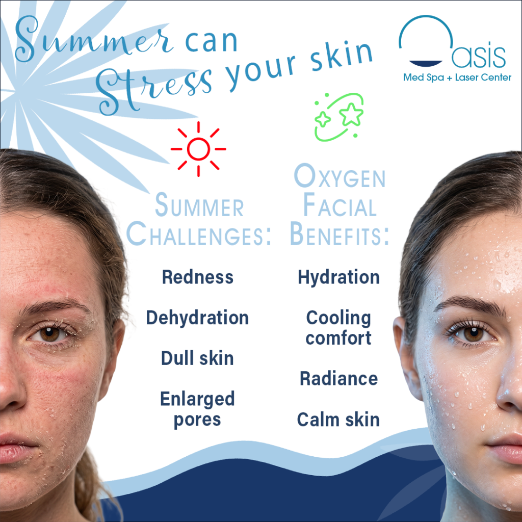 Comparison graphic illustrating how summer can affect the skin. One side shows skin with redness and dryness, while the other shows hydrated, radiant skin. The text contrasts common summer skin concerns with Oxygen Facial benefits like hydration, cooling comfort, radiance, and calmer skin.