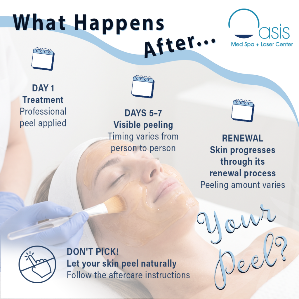 Oasis Med Spa graphic detailing the chemical peel recovery timeline, peeling process, and skin renewal aftercare.